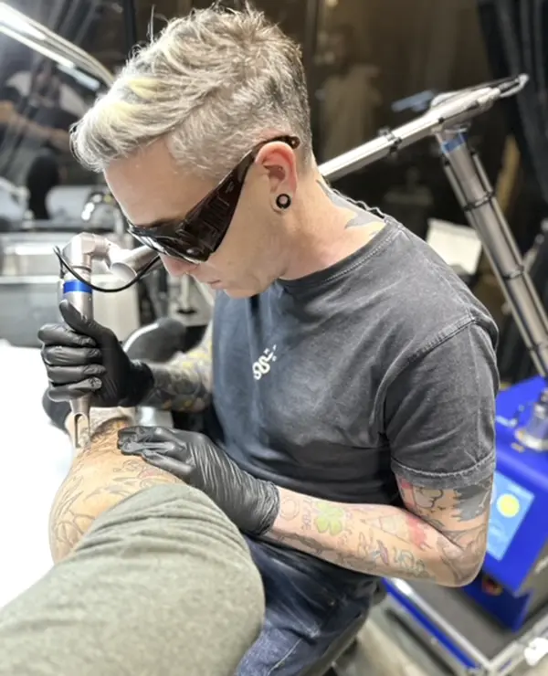 Estudio eliminación tatuajes a medida Miki Tattoo Killer. acelerar la eliminación del tatuaje