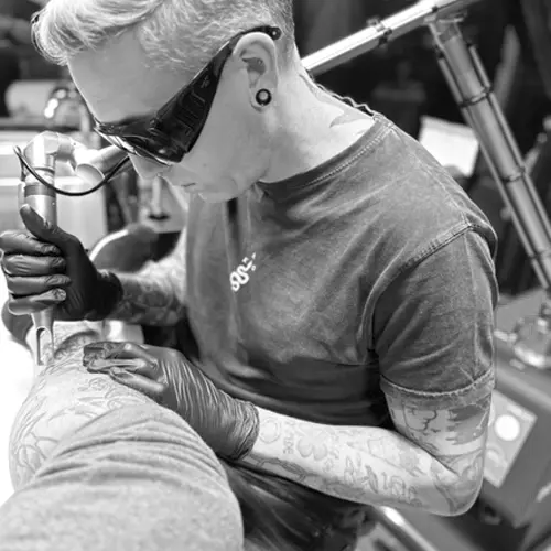 Miki Tattoo Killer maquina eliminar tatuajes