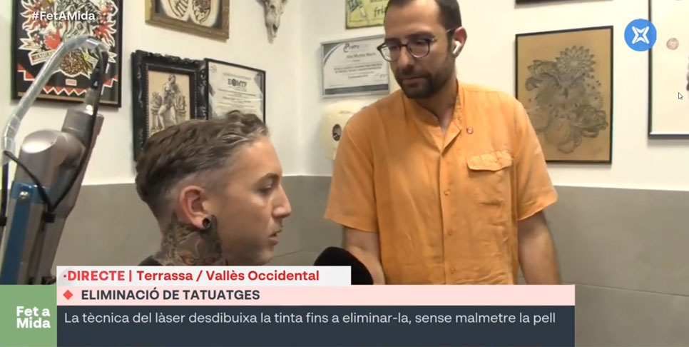 eliminación tatuajes en terrassa entrevista en directo