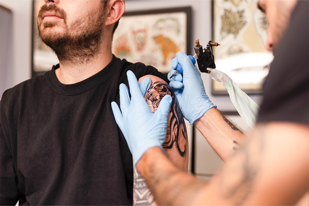 Tomar la decisión de eliminar un tatuaje puede ser impulsada por diversas razones, ya sea un error de diseño, un cambio de opinión, o una reacción alérgica. Para aquellos que se arrepienten rápidamente, la pregunta clave es si es posible eliminar un tatuaje recién hecho. Entender el proceso de curación del tatuaje y las recomendaciones médicas es crucial para tomar una decisión informada. El Proceso de curación de un tatuaje Un tatuaje recién hecho es esencialmente una herida abierta que necesita tiempo para sanar. Durante las primeras semanas, la piel pasa por varias etapas de curación que incluyen inflamación, formación de costras, y finalmente la regeneración de la piel. Este proceso puede durar de 4 a 6 semanas o más, dependiendo de la ubicación y tamaño del tatuaje, así como de la salud general del individuo. Por qué ❌ NO ❌ es recomendable eliminar un tatuaje recién hecho Eliminar un tatuaje recién hecho no es recomendable por varias razones: Riesgo de Infección: La piel recién tatuada es muy sensible y propensa a infecciones. Someterla a un tratamiento láser durante el proceso de curación puede aumentar significativamente el riesgo de infecciones. Daño a la piel: El tratamiento láser en piel que aún se está curando puede causar daños adicionales, cicatrices permanentes y complicar aún más la eliminación del tatuaje en el futuro. Resultados ineficaces: La piel necesita estar completamente curada para que el tratamiento láser sea efectivo. El láser funciona mejor en tinta asentada y bien curada. Tratar un tatuaje antes de que la piel esté completamente curada puede resultar en una eliminación ineficaz y desigual. Cuándo es seguro comenzar la eliminación con láser En MikiTattooKiller recomendamos esperar al menos 6 meses antes de iniciar el tratamiento con láser. Este período permite que la piel se cure completamente y que la tinta se asiente en las capas más profundas de la piel, lo que mejora la efectividad del tratamiento láser. El proceso de eliminación con láser Una vez que la piel está completamente curada, el proceso de eliminación con láser puede comenzar. El láser trabaja descomponiendo la tinta en partículas más pequeñas que el sistema inmunológico del cuerpo puede eliminar gradualmente. Cada sesión de tratamiento descompone más tinta, y el cuerpo necesita tiempo para eliminar estas partículas antes de la siguiente sesión. El número de sesiones necesarias varía según el tamaño, color y ubicación del tatuaje, así como la respuesta individual del cuerpo al tratamiento. En general, pueden ser necesarias entre 6 y 10 sesiones para una eliminación completa, espaciadas entre 4 a 8 semanas. Consejos para tapar un tatuaje mientras se cura Si necesitas ocultar un tatuaje recién hecho mientras se cura, aquí tienes algunas estrategias efectivas: Ropa holgada y de tejidos naturales: Usa prendas holgadas y hechas de materiales naturales como el algodón. Evita la ropa ajustada para minimizar la fricción y la irritación. Apósitos transpirables Especializados: Utiliza apósitos diseñados específicamente para tatuajes. Estos protegen la zona de la suciedad y bacterias mientras permiten la ventilación. Maquillaje a prueba de agua y de larga duración: Para ocasiones especiales, considera el maquillaje diseñado para cubrir tatuajes. Asegúrate de que el tatuaje esté limpio e hidratado antes de aplicar el maquillaje. Aplica una capa ligera y uniforme para un acabado natural. Estos métodos te permitirán ocultar tu tatuaje mientras se cura sin comprometer su proceso de sanación. Cuando ya hayan pasado 6 meses puedes consultar con nuestro equipo a través del formulario de contacto, Instagram o WhatsApp para obtener una evaluación precisa y un plan de tratamiento personalizado. ¡Podrás despedirte de ese tatuaje no deseado para siempre!